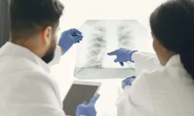 due medici osservano lastra di uomo con liquido nei polmoni