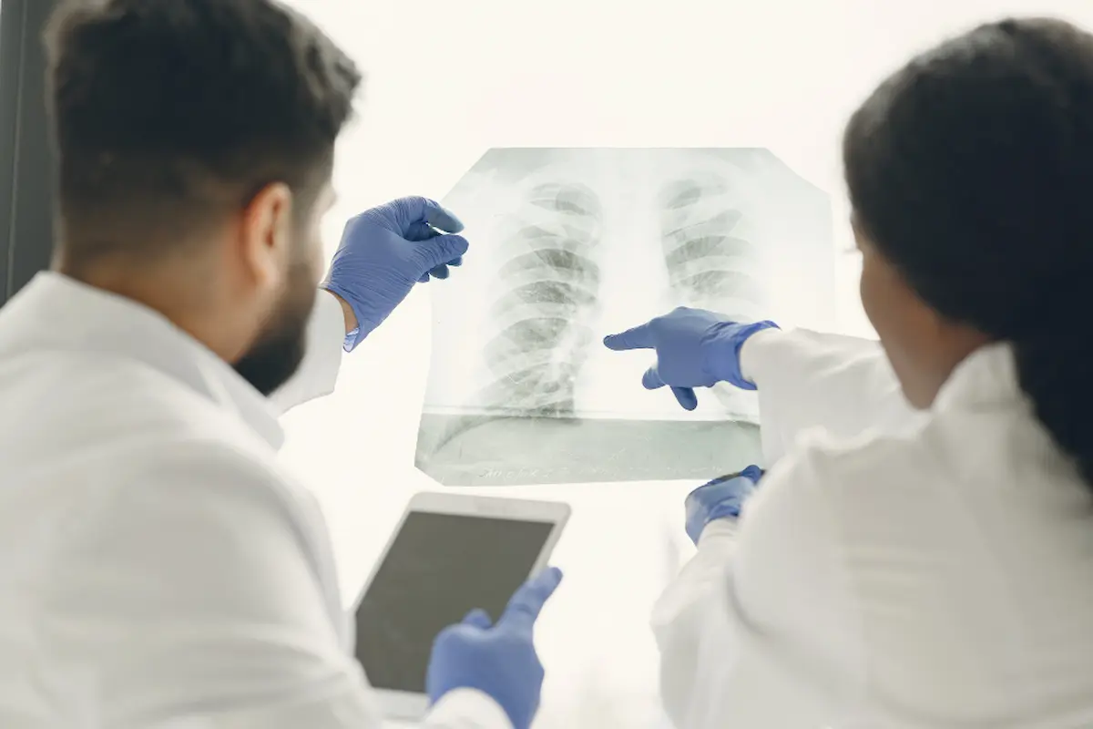 due medici osservano lastra di uomo con liquido nei polmoni