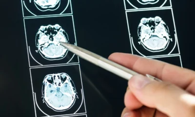 dottoressa spiega problemi in una visita neurologica