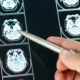 dottoressa spiega problemi in una visita neurologica