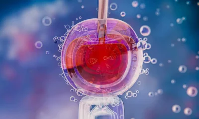 immagine esempio dell'estrazione del dna fetale