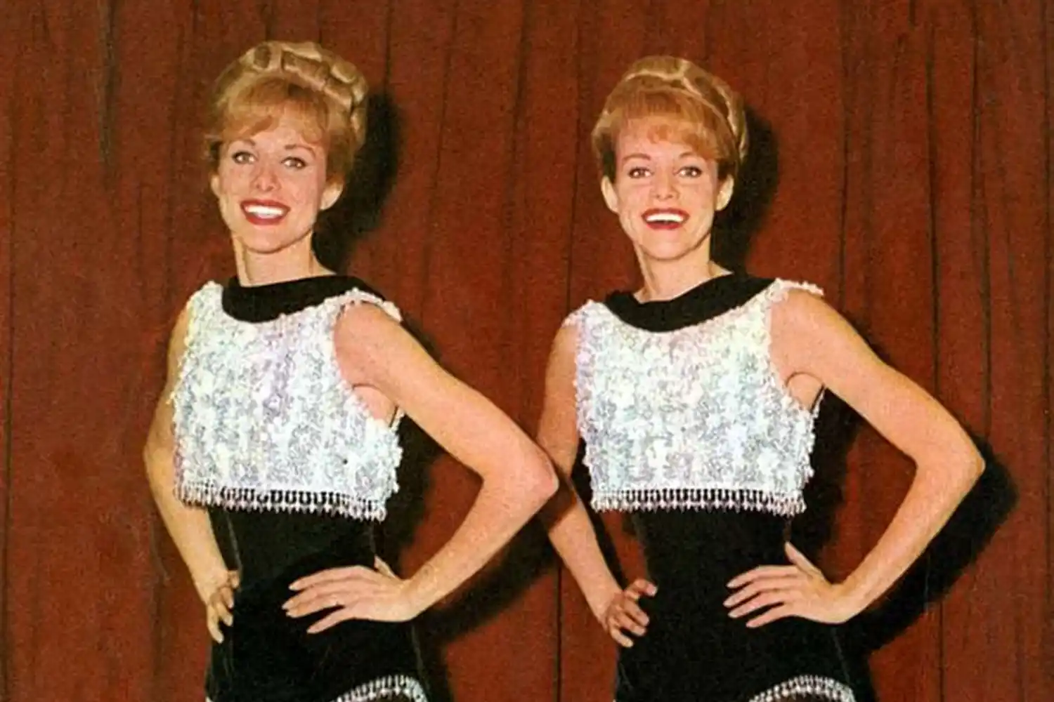 gemelle Kessler morte insieme