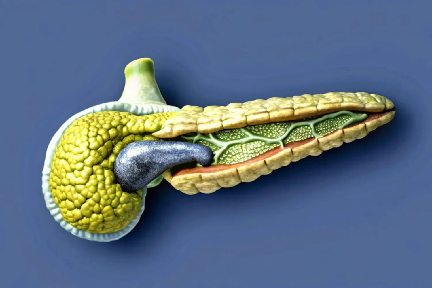 Spagna cura contro il tumore al pancreas