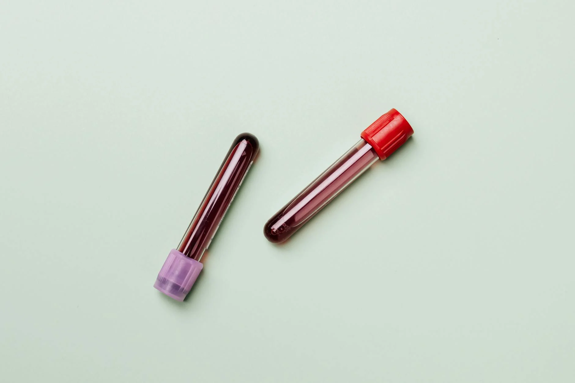 Resultados de análisis con tubo de sangre para explicar monociti alti analisi en un contexto médico