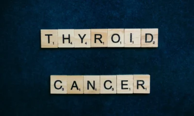 Ecografía de thyroid ultrasound para ilustrar un artículo sobre controllo tiroide ogni anno y cuándo conviene realmente hacer seguimiento.