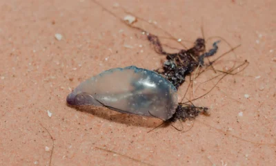 Persona con dolor en la piel tras una cosa fare dopo una puntura di medusa en la playa
