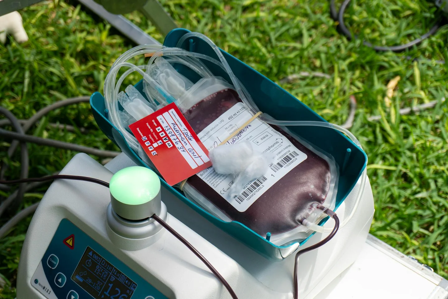 Foto de una blood donation bag relacionada con la búsqueda "quale gruppo sanguigno può donare a tutti" para ilustrar un artículo sobre compatibilidad sanguínea y donación.