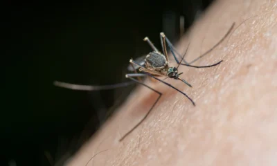 Primer plano de una picadura de mosquito con piel irritada, ideal para ilustrar perché le punture di zanzara prudono.
