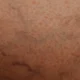 Ilustración de leg vein anatomy para explicar dove si trova la vena safena en el recorrido interno de la pierna.