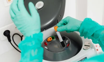 Paciente en un laboratorio de análisis con el contexto de si puo bere acqua prima di esami sangue, preparado para un prelievo de sangre
