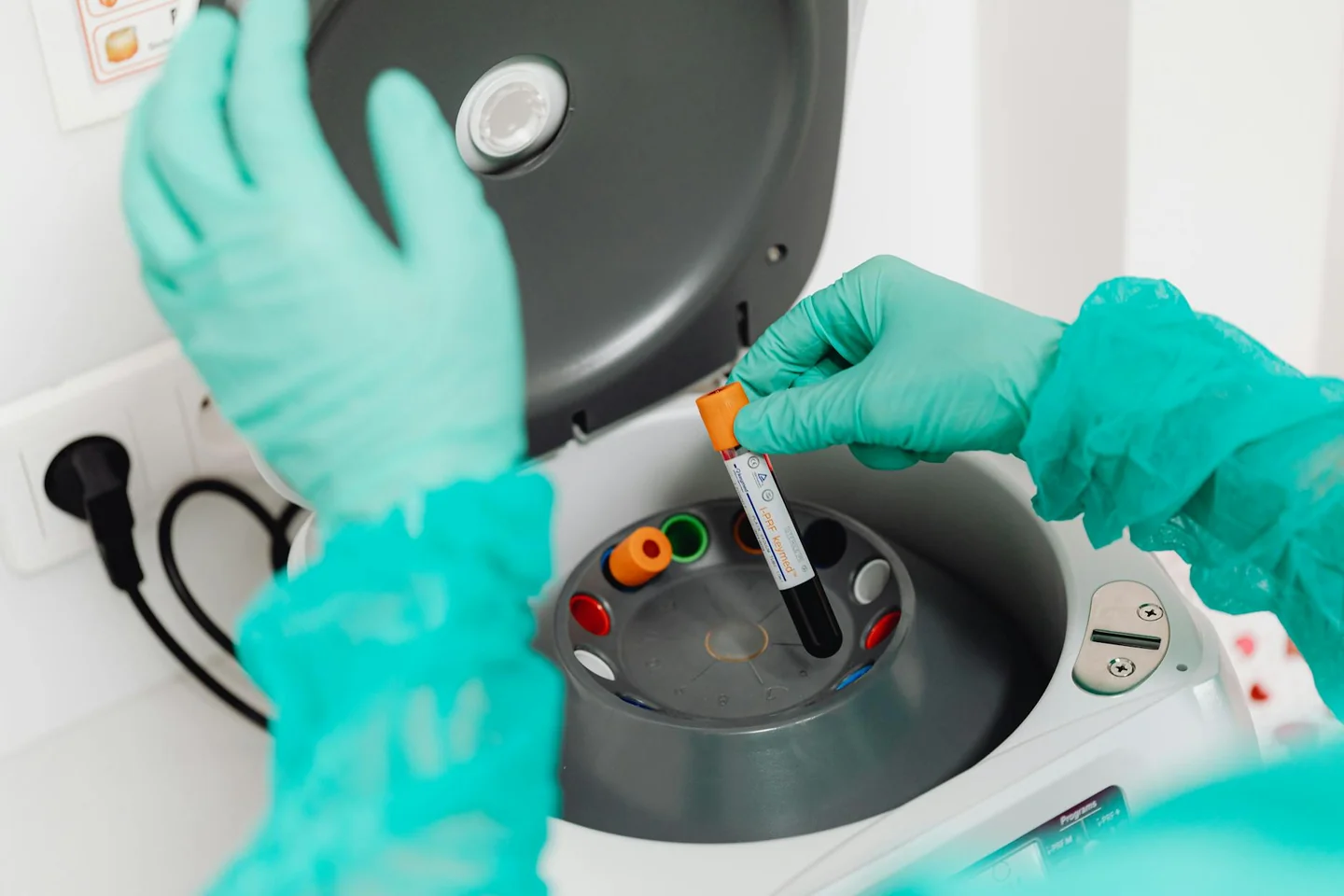 Paciente en un laboratorio de análisis con el contexto de si puo bere acqua prima di esami sangue, preparado para un prelievo de sangre