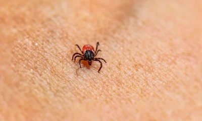 Primer plano de una tick on skin relacionado con come riconoscere una puntura di zecca