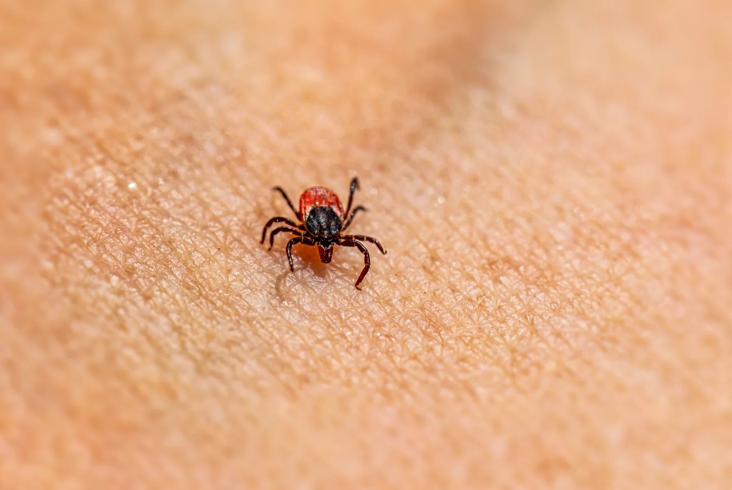 Primer plano de una tick on skin relacionado con come riconoscere una puntura di zecca