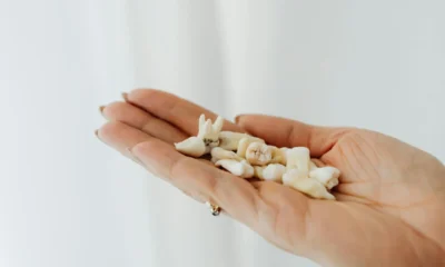 Imagen de wisdom tooth pain para ilustrar el artículo sobre quanti sono i denti del giudizio